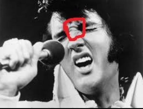 Crease at top of Elvis' nose matches Jesse