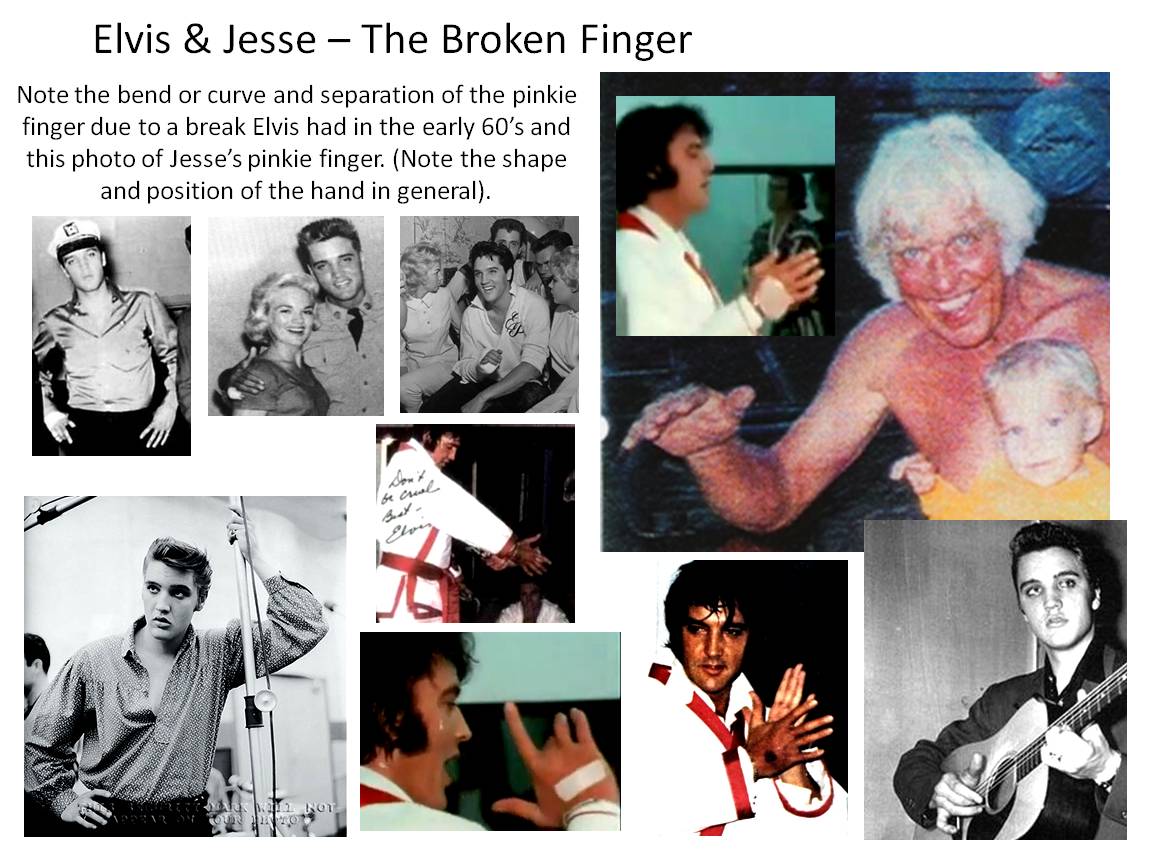 Elvis-Jesse-TheBroken-Finger